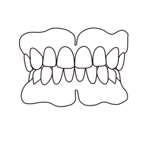 complete denture