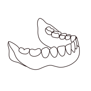 complete denture