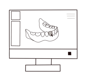 digital dentures